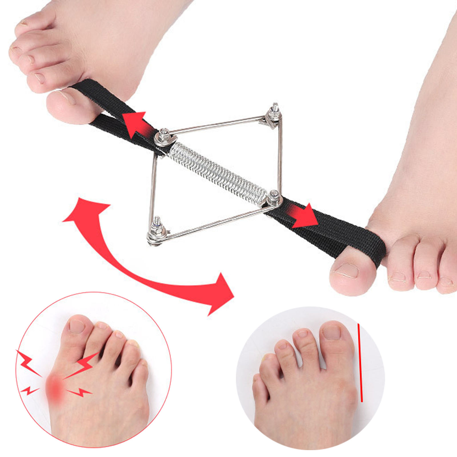 Corrector de juanete de nailon - Pilates Yoga Wellness reseña y precio
